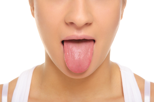 舌苔(ぜったい)